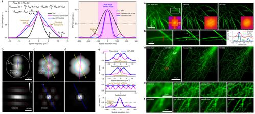 蘇州醫(yī)工所結(jié)構(gòu)光照明超分辨顯微成像技術研究取得系列進展